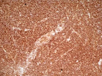 Anti-CD36 antibody [SMØ] used in IHC (Frozen sections) (IHC-Fr). GTX76435