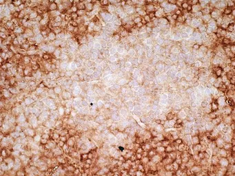 Anti-CD36 antibody [SMØ] (Azide free) used in IHC (Frozen sections) (IHC-Fr). GTX76436