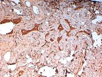 Anti-Cytokeratin 14 antibody [LL002] used in IHC (Paraffin sections) (IHC-P). GTX76603
