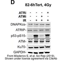 Anti-Ku70 antibody [529] used in Western Blot (WB). GTX77607