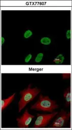 Anti-Ku70 antibody [529] used in Immunocytochemistry/ Immunofluorescence (ICC/IF). GTX77607