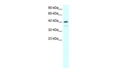 Anti-LIM1 antibody, C-term used in Western Blot (WB). GTX77778