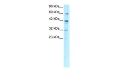 Anti-E2F4 antibody, C-term used in Western Blot (WB). GTX77806