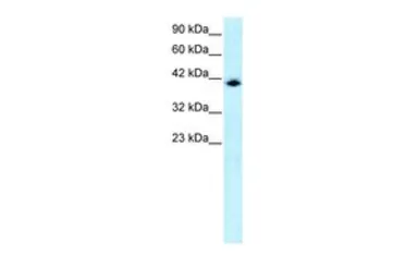 Anti-IRF9 antibody, N-term used in Western Blot (WB). GTX77807