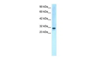 Anti-SNF8 antibody, N-term used in Western Blot (WB). GTX77812