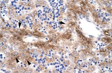 Anti-Steroidogenic Factor 1 antibody, Internal used in IHC (Paraffin sections) (IHC-P). GTX77813