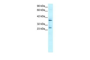 Anti-SIRT5 antibody, C-term used in Western Blot (WB). GTX77826