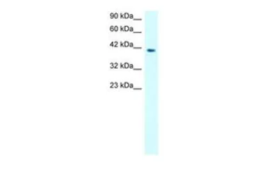 Anti-MMP19 antibody, N-term used in Western Blot (WB). GTX77827