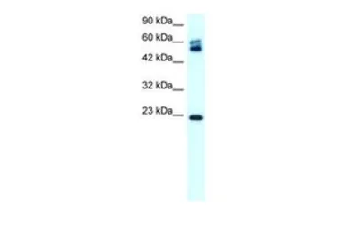 Anti-Claudin 8 antibody, C-term used in Western Blot (WB). GTX77832