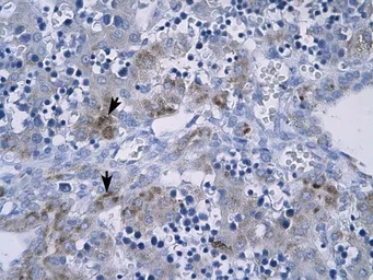 Anti-RGS9 antibody, N-term used in IHC (Paraffin sections) (IHC-P). GTX77834