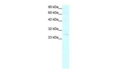 Anti-GAS41 antibody, Internal used in Western Blot (WB). GTX77840