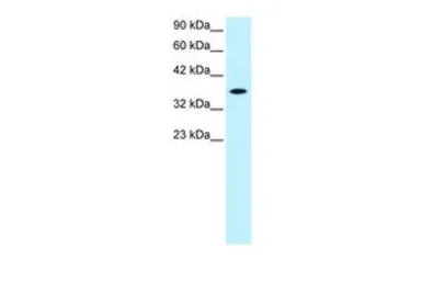 Anti-RAX antibody, N-term used in Western Blot (WB). GTX77868