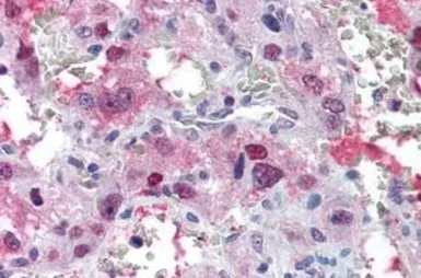 Anti-AVPR1B antibody used in IHC (Paraffin sections) (IHC-P). GTX78015