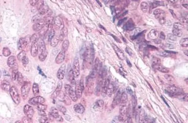 Anti-NR0B1 antibody used in IHC (Paraffin sections) (IHC-P). GTX78099