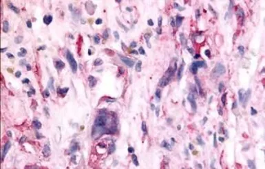Anti-TAOK1 antibody used in IHC (Paraffin sections) (IHC-P). GTX78125
