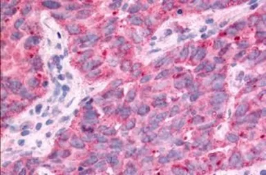 Anti-TAOK1 antibody used in IHC (Paraffin sections) (IHC-P). GTX78125