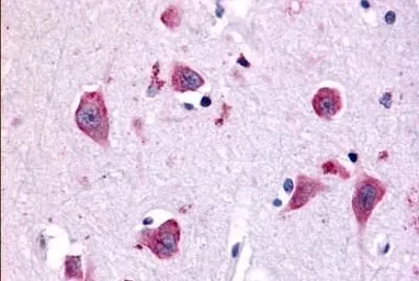 Anti-TAOK1 antibody used in IHC (Paraffin sections) (IHC-P). GTX78125