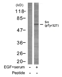 Anti-Src (phospho Tyr530) antibody used in Western Blot (WB). GTX78941