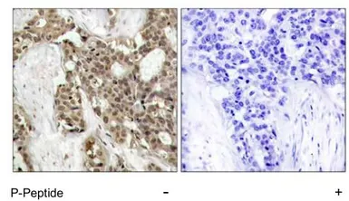 Anti-ERK1 (phospho Tyr204) + ERK2 (phospho Tyr187) antibody used in IHC (Paraffin sections) (IHC-P). GTX78987