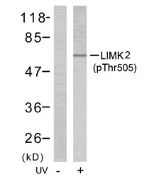 Anti-LIM kinase 2 (phospho Thr505) antibody used in Western Blot (WB). GTX79022