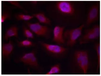 Anti-ATF2 (phospho Thr73) antibody used in Immunocytochemistry/ Immunofluorescence (ICC/IF). GTX79132
