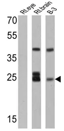 Anti-Recoverin antibody [6a55 cd6] used in Western Blot (WB). GTX79211