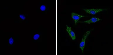 Anti-Recoverin antibody [6a55 cd6] used in Immunocytochemistry/ Immunofluorescence (ICC/IF). GTX79211