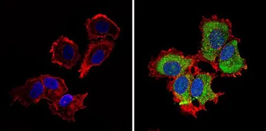 Anti-IGF2R antibody used in Immunocytochemistry/ Immunofluorescence (ICC/IF). GTX79239