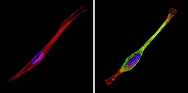 Anti-IGF2R antibody used in Immunocytochemistry/ Immunofluorescence (ICC/IF). GTX79239