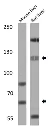 Anti-SREBP1 antibody used in Western Blot (WB). GTX79299
