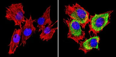 Anti-SREBP1 antibody used in Immunocytochemistry/ Immunofluorescence (ICC/IF). GTX79299