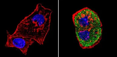 Anti-SREBP1 antibody used in Immunocytochemistry/ Immunofluorescence (ICC/IF). GTX79299