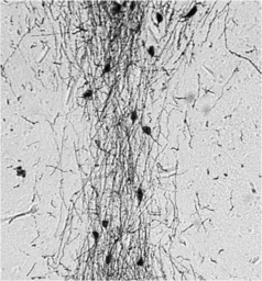 Anti-GnRH antibody used in IHC (Paraffin sections) (IHC-P). GTX79310