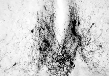 Anti-GnRH antibody used in IHC (Paraffin sections) (IHC-P). GTX79310