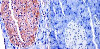 Anti-TIMP2 antibody [F27 P3 A4] used in IHC (Paraffin sections) (IHC-P). GTX79355