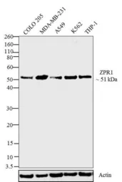 Anti-ZNF259 antibody [LG1] used in Western Blot (WB). GTX79362