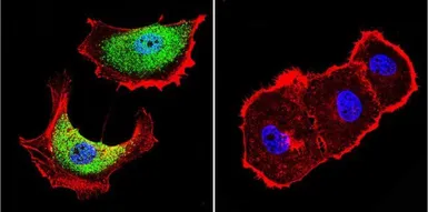 Anti-ZNF259 antibody [LG1] used in Immunocytochemistry/ Immunofluorescence (ICC/IF). GTX79362