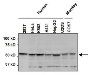 Anti-FKBP4 antibody used in Western Blot (WB). GTX79366