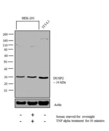 Anti-DUSP2 antibody used in Western Blot (WB). GTX79395