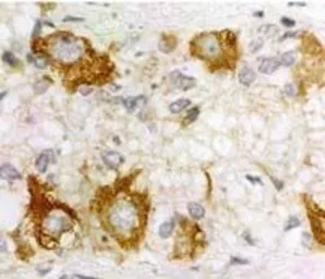 Anti-DUSP2 antibody used in IHC (Paraffin sections) (IHC-P). GTX79395