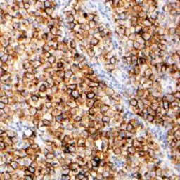 Anti-Placental Alkaline Phosphatase antibody [SP15] (ready-to-use) used in Immunohistochemistry (IHC). GTX79434