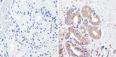 Anti-CYP3A7 antibody [F19 P2 H2] used in IHC (Paraffin sections) (IHC-P). GTX79463