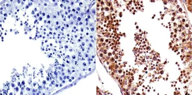 Anti-VRK1 antibody [1F6] used in IHC (Paraffin sections) (IHC-P). GTX79470