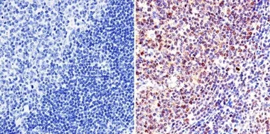 Anti-VRK1 antibody [1F6] used in IHC (Paraffin sections) (IHC-P). GTX79470