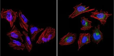 Anti-VRK1 antibody [1F6] used in Immunocytochemistry/ Immunofluorescence (ICC/IF). GTX79470