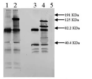 Anti-tPA antibody used in Western Blot (WB). GTX79623
