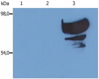 Anti-Transferrin antibody [PTF-02] used in Western Blot (WB). GTX79901