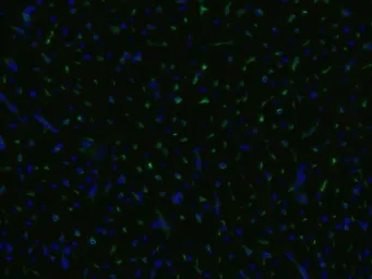 Anti-CD105 antibody [MEM-229] (PE) used in Immunocytochemistry/ Immunofluorescence (ICC/IF). GTX79975