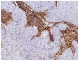 Anti-CD66e antibody [CB30] used in IHC (Paraffin sections) (IHC-P). GTX80201