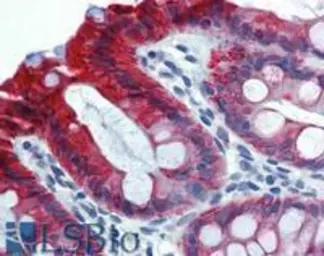Anti-Cytokeratin 18 antibody [C-04] (FITC) used in IHC (Paraffin sections) (IHC-P). GTX80207